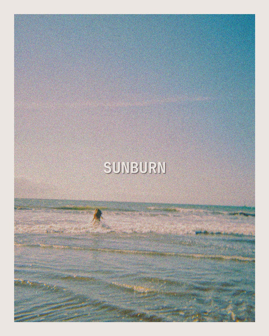 SUNBURN